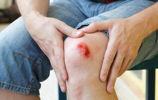 9 علامت عفونت و آلودگی زخم که باید جدی بگیرید 9 علامت عفونت و آلودگی زخم که باید جدی بگیرید