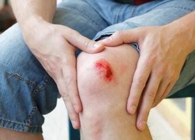 9 علامت عفونت و آلودگی زخم که باید جدی بگیرید