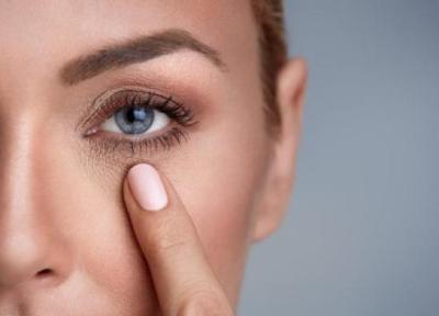 راهکارهای طبیعی برای درمان سیاهی دور چشم