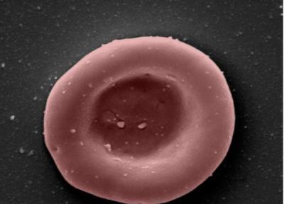 اولین آزمایش جهانی استقاده از سلول های قرمز خون آزمایشگاهی آغاز شد