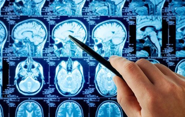 آیا استفاده از گوشی های هوشمند خطر سرطان مغز را افزایش می دهد؟